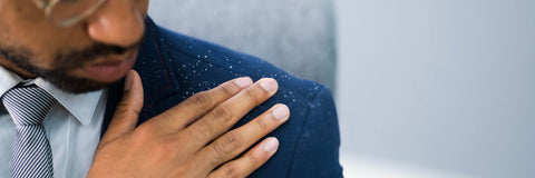 The Lowdown on Dandruff & How to Be Flake Free